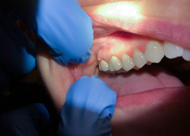 Best Emergency Treatment for Jaw Pain or Injury in Evergreen, AL