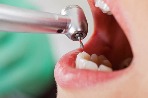 Best Broken or Chipped Tooth Repair in Evergreen, AL